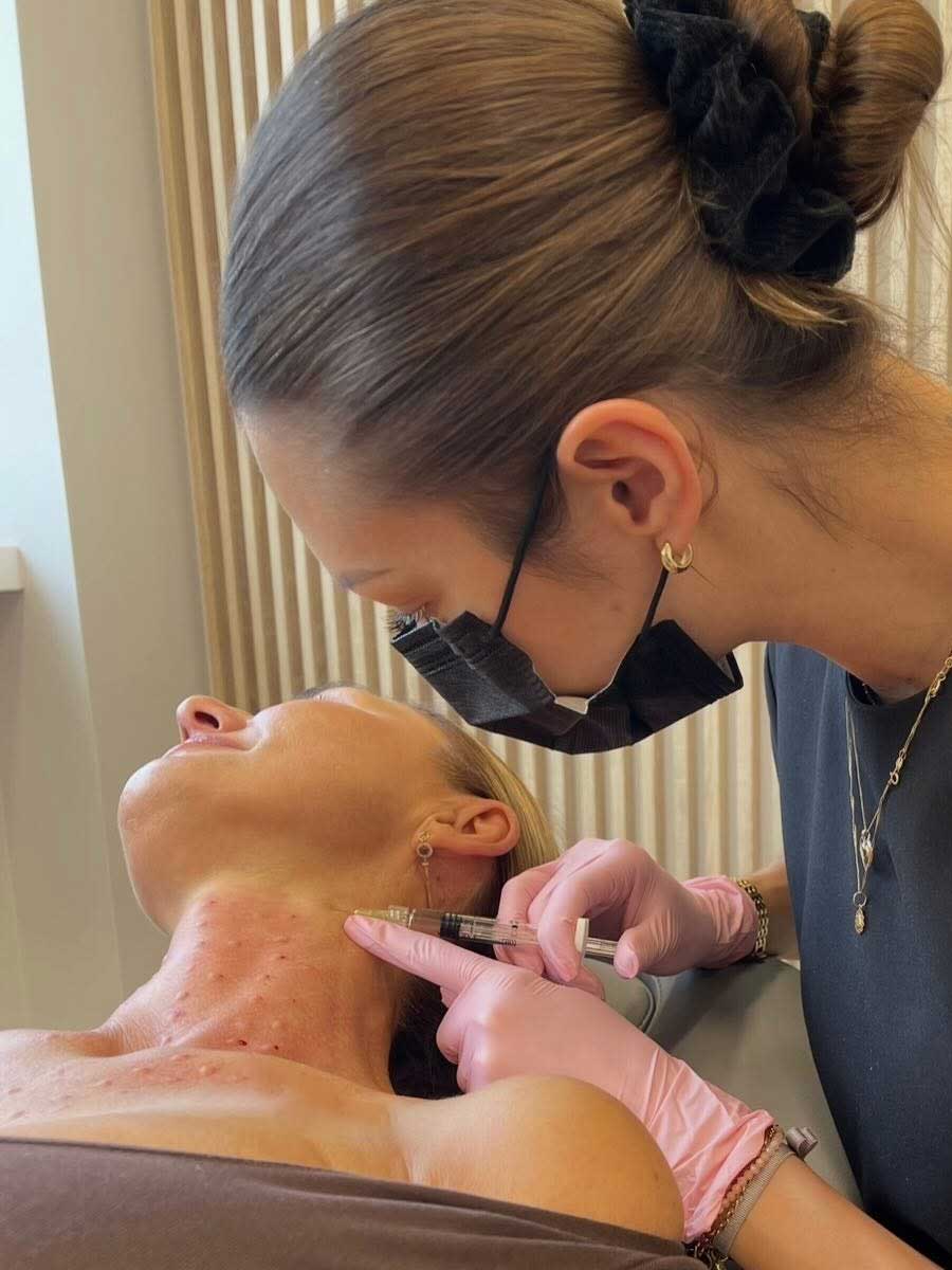 Mezoterapia igłowa szyi i dekoltu — podanie preparatu cienką igłą